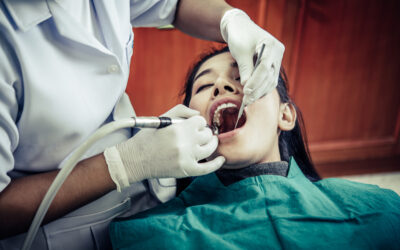 Gingivitis: Understanding the First Stage of Gum Disease