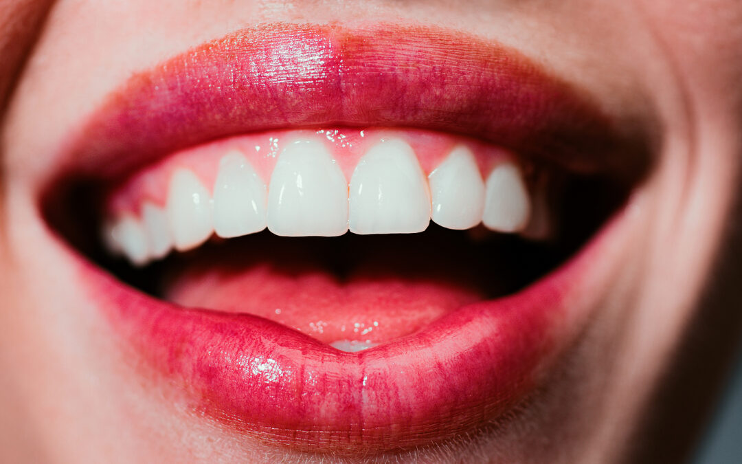 Unleash Your Gorgeous Smile with Sinsational Tooth Whitening