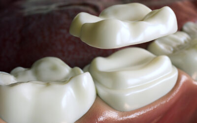 How Strong Are Porcelain Crowns? Unveiling the Resilience of Your Smile
