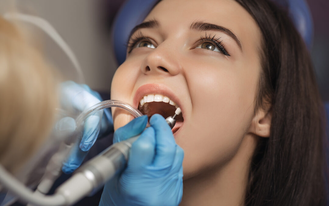 How Long Does Teeth Cleaning Take at Diablo Dental Group?