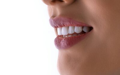 Cosmetic Dental Implants: Everything You Need to Know